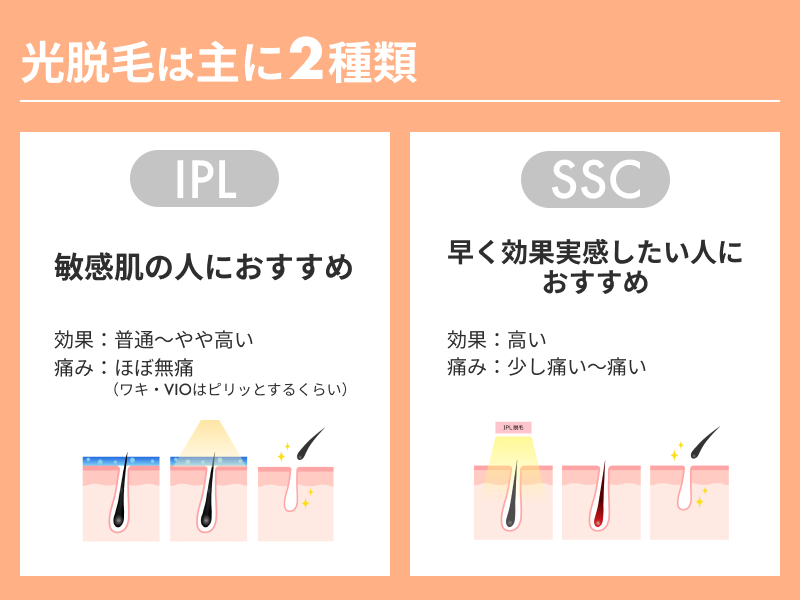 脱毛サロンで採用している脱毛方法